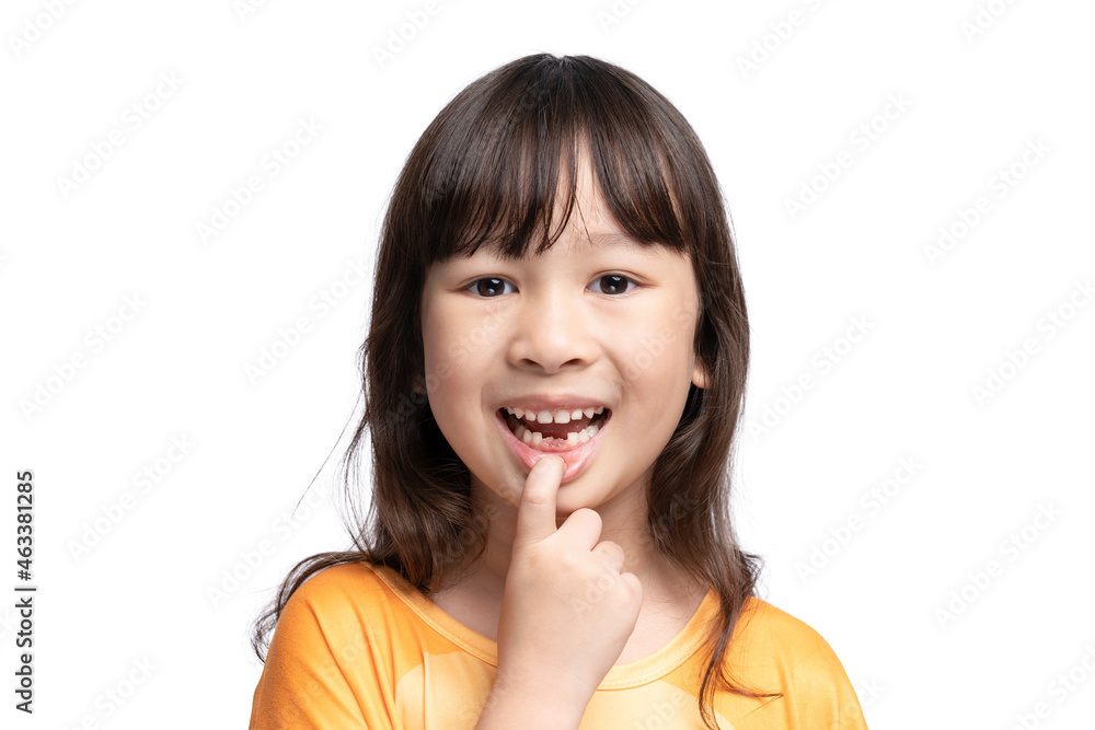 Cute Asian girl smiling showing her missing teeth in her mouth..Tooth loss by age concept, replacement of permanent teeth. Tooth removal. Cute Asian girl smiling showing her missing teeth in her mouth..Tooth loss by age concept, replacement of permanent teeth. Tooth removal.