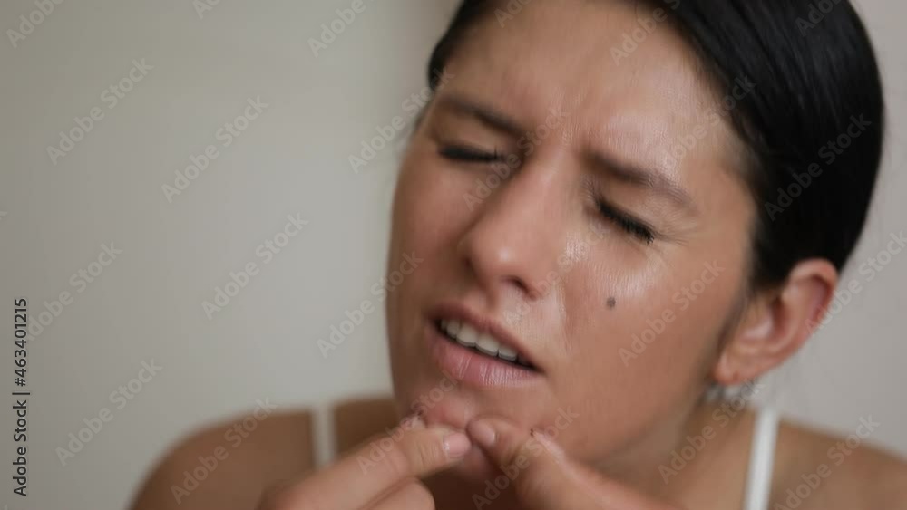 woman looking at pimple on face. Young Woman try to remove her pimple. woman looking at pimple on face. Young Woman try to remove her pimple.