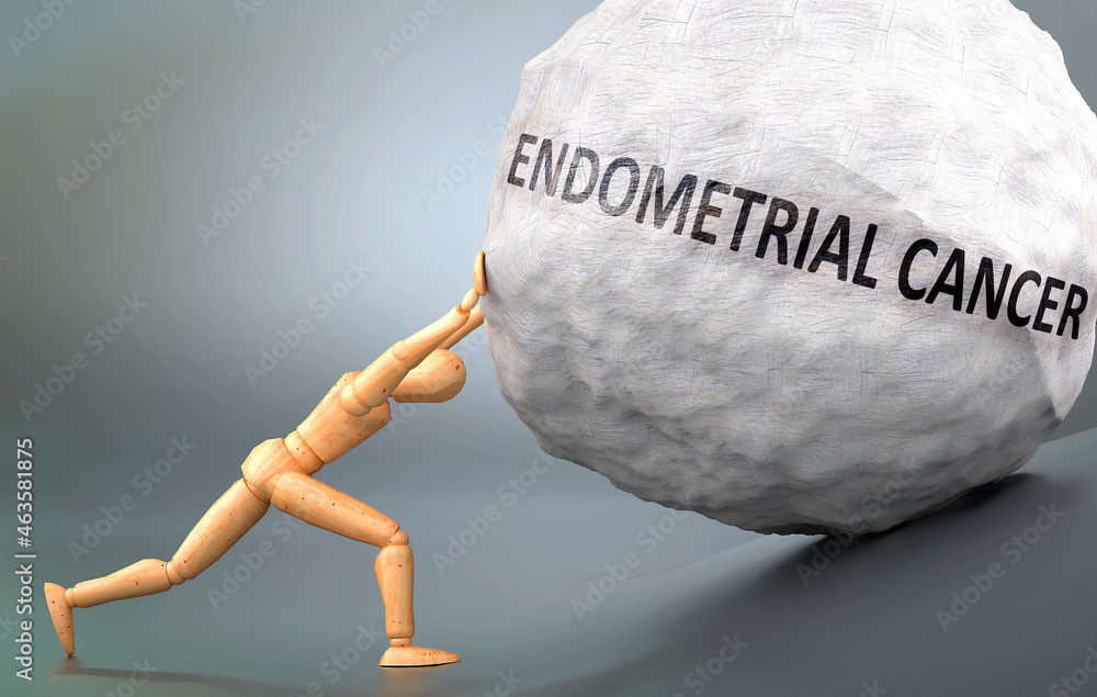 Depiction of Endometrial cancer shown a wooden model pushing heavy