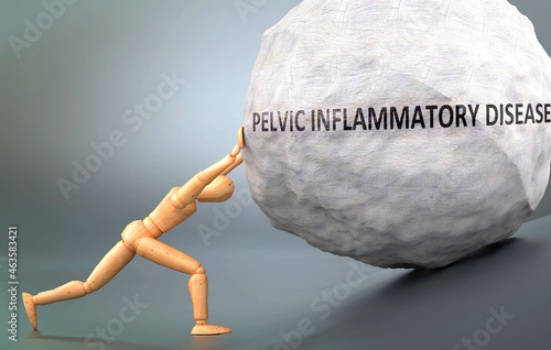 Depiction of Pelvic inflammatory disease shown a wooden model pushing heavy weight to symbolize struggle and pain when dealing with Pelvic inflammatory disease, 3d illustration photo