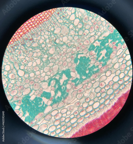 microscopic photo of Celastrus scandens stem photo