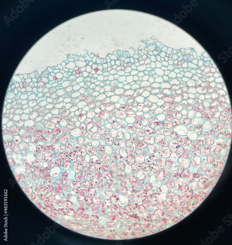 microscopic photo of nymphaea aquatic stem photo