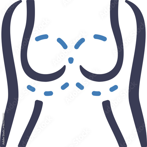 breast augmentation