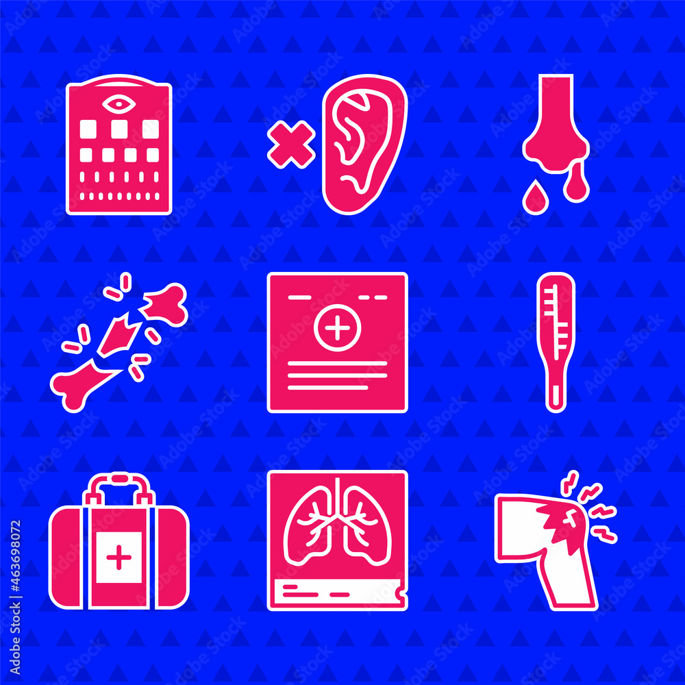 Set Clinical record, Lungs xray, Joint pain, knee pain, Medical