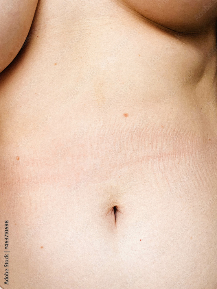 Female stomach 2 Female stomach 2