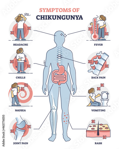 Chikungunya symptoms awareness poster, educational vector illustration diagram. Infection disease diagnosis - headache, chills, nausea, joint paint, fever, back pain, vomiting and skin rash. photo