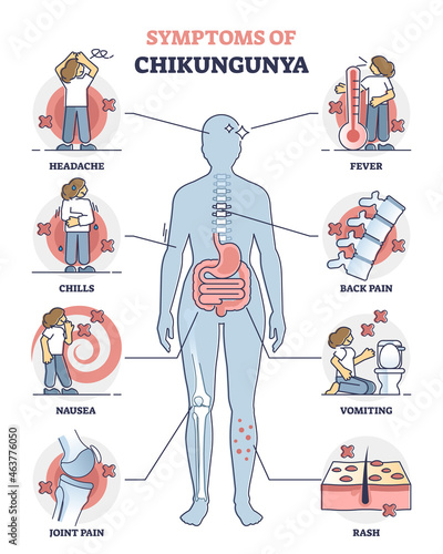 Chikungunya symptoms awareness poster, educational vector illustration diagram. Infection disease diagnosis - headache, chills, nausea, joint paint, fever, back pain, vomiting and skin rash.