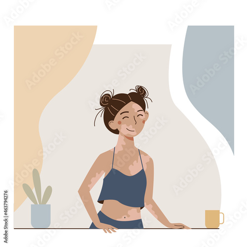 Cute cartoon young woman with vitiligo desease in a window.