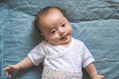Baby girl with Down Syndrome Looking at the camera