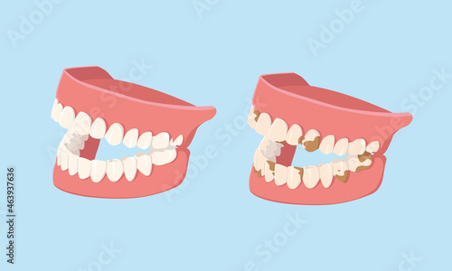 Human jaws isolated on white background. Clean and dirty teeth. Dental model of human jaws. Healthy oral hygiene. Trendy graphic for stomatology, dentist. Vector illustration