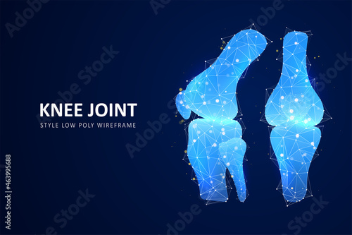 Abstract polygonal knee-joint