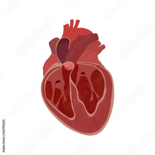 Enlarged heart, illustration photo