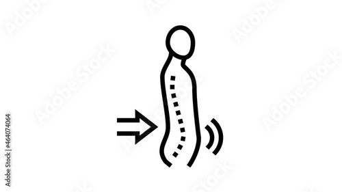 lordosis disease animated line icon. lordosis disease sign. isolated on white background photo