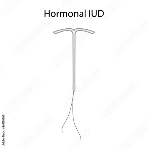 Hormonal intrauterine devices. Contraception methods. Vector medical illustration.