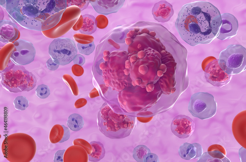 Acute lymphoblastic leukemia (ALL) cancer cells in the blood flow - closeup view 3d illustration photo