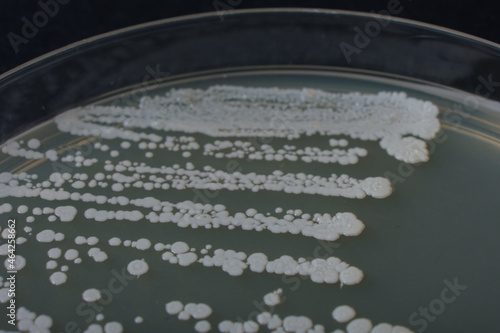 closeup photo of growth of bacteria clolonies on agar media photo