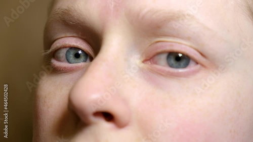 close-up woman looking at the camera, horizontal nystagmus, woman with uncontrolled rhythmic movements of the eyeballs. eyes health concept