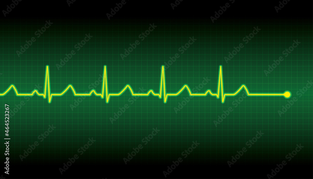 Vector illustration of a heart pulse