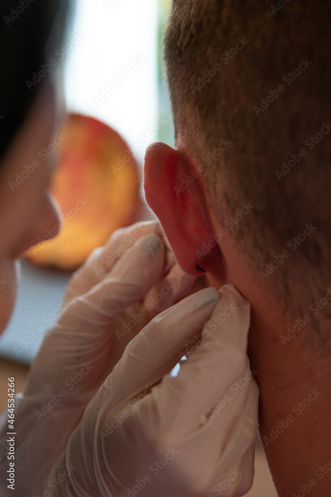 the girl makes a professional puncture of the ear to the guy in the medical center. Beauty salon and piercing master concept