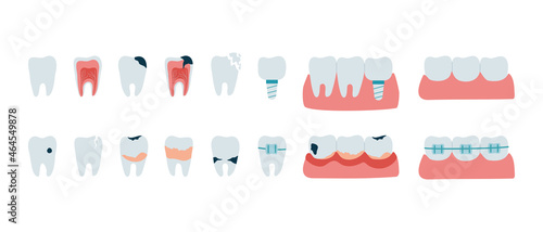 Set of teeth with dental diseases. Oral problems, caries, tartar, plaque, implant, orthodontic braces, various injuries. Collection of dentistry icons in flat style. Isolated vector illustration.