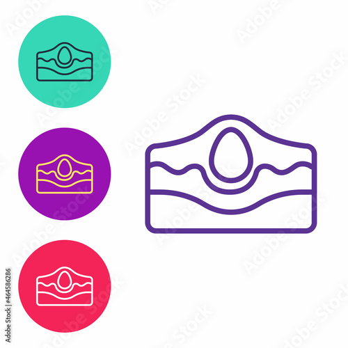 Set line Acne icon isolated on white background. Inflamed pimple on the skin. The sebum in the clogged pore promotes the growth of a bacteria. Set icons colorful. Vector