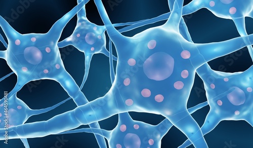 Neural disease, Neurons with lewy bodies in Parkinson's disease or Dementia photo