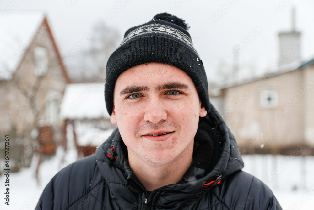 Close-up portrait of young man in warm hat outside on rural winter snowy house background. Happy millennial smiling outdoor, cold weather. Caucasian guy 20-25 years. Face with acne or herpes Close-up portrait of young man in warm hat outside on rural winter snowy house background. Happy millennial smiling outdoor, cold weather. Caucasian guy 20-25 years. Face with acne or herpes