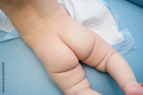 a small nursing baby with a bare bottom lies on a changing table on a diaper on a massage on his stomach