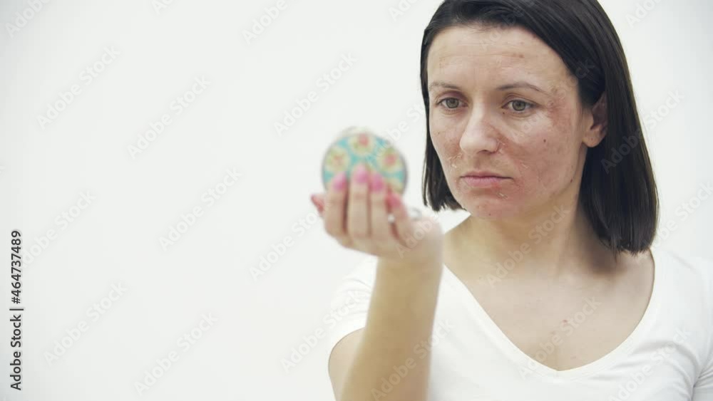 4k close up slowmotion video of woman with dry skin. 4k close up slowmotion video of woman with dry skin.