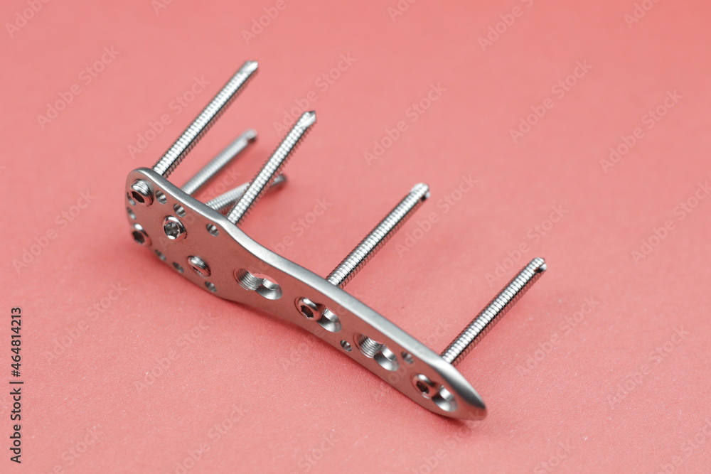 Surgical plate for osteosynthesis in case of bone fractures Stock Photo