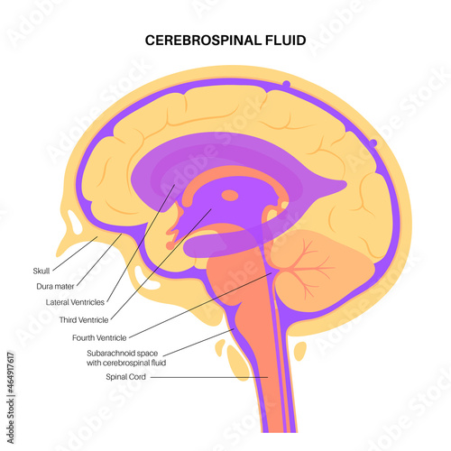 Ventricular system concept