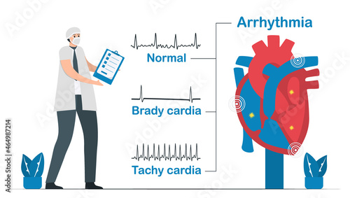Normal heart signal is compared with 2 types of arrhythmia. It includes tachycardia and bradycardia. Cardiology vector illustration isolated on white background.
