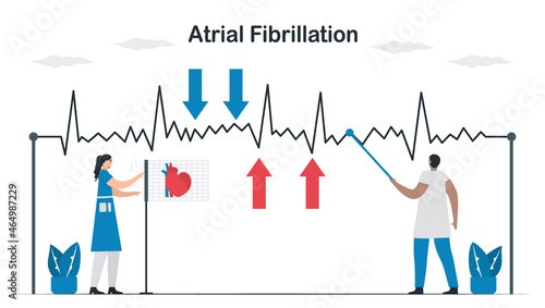 ECG signal of atrial fibrillation. Doctors check and analyze a heart disease. Cardiology vector illustration.