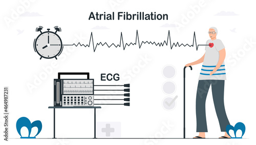 An electrocardiogram was used to analyse for atrial fibrillation problem. Cardiology vector illustration in flat style.