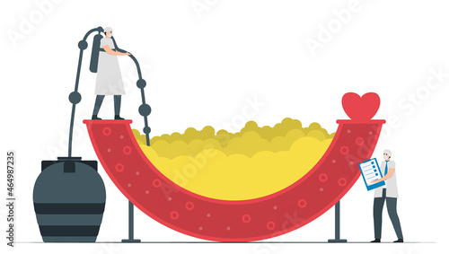 Doctor sucks fat in blood vessel. Coronary artery disease treatment. Cardiology vector illustration isolated on white background.