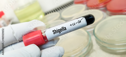 Blood sample tube for Shigella test, Shigella infection or shigellosis photo