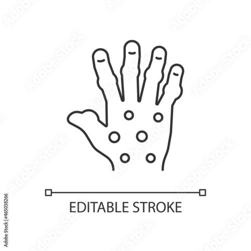 Psoriatic arthritis linear icon. Painful finger and hand joints. Permanent bones damage. Thin line customizable illustration. Contour symbol. Vector isolated outline drawing. Editable stroke