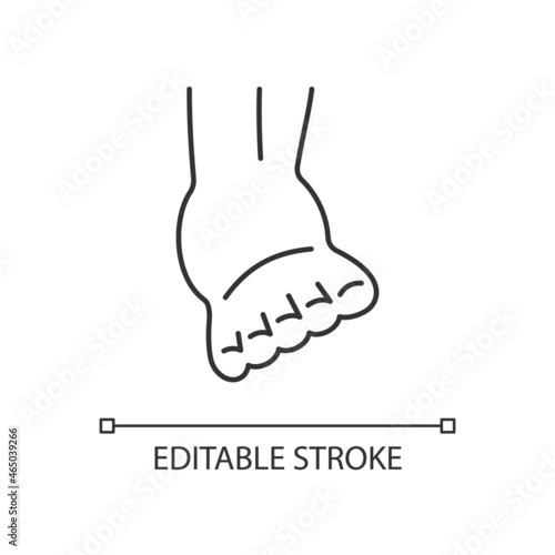 Joint sprain linear icon. Ankle ligaments tearing. Sports injury. Overstretched joint. Thin line customizable illustration. Contour symbol. Vector isolated outline drawing. Editable stroke