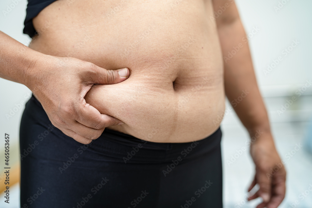 Naklejka premium Overweight Asian woman show fat belly at office.