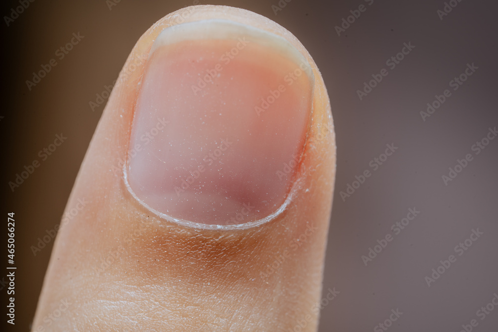 Fototapeta premium Women's fingernails health.close up