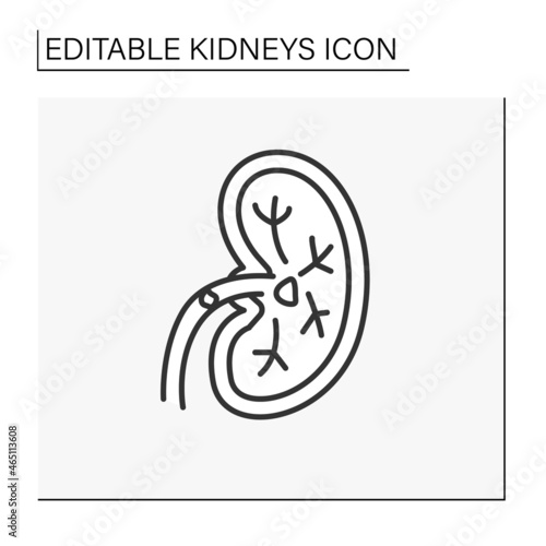 Kidney line icon. Unhealthy internal organ.Kidney stones. Renal calculi, nephrolithiasis or urolithiasis. Healthcare concept.Isolated vector illustration.Editable stroke