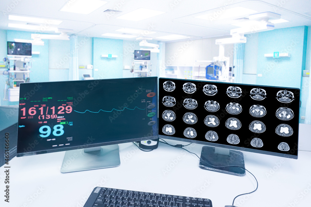 Motion blur in the emergency room hospital, a monitor showing Vital signs, and MRI brain scan , Medical healthcare concept. Motion blur in the emergency room hospital, a monitor showing Vital signs, and MRI brain scan , Medical healthcare concept.