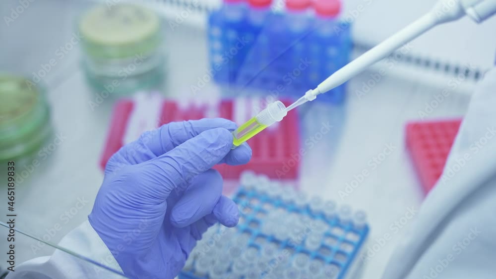 Medical personnel in the laboratory takes sample of yellow liquid from test cup with pipette Medical personnel in the laboratory takes sample of yellow liquid from test cup with pipette
