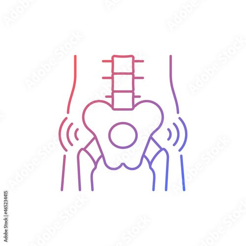 Hips rheumatism gradient linear vector icon. Degenerative joint disease. Intense pain. Cartilage in hip worn away. Thin line color symbol. Modern style pictogram. Vector isolated outline drawing