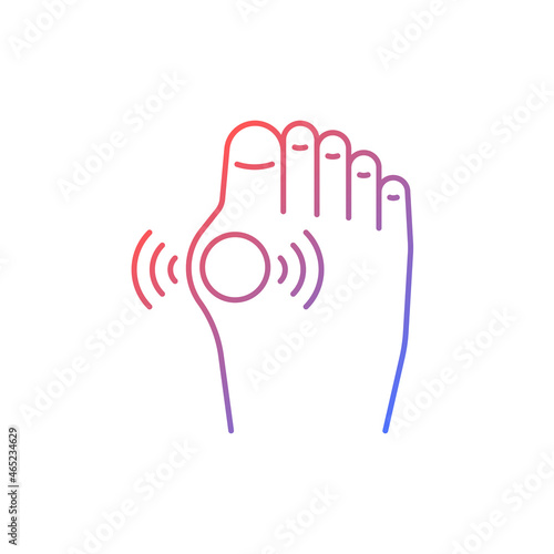Gout gradient linear vector icon. Inflammatory arthritis type. Uric acid buildup. Affecting joint in big toe. Thin line color symbol. Modern style pictogram. Vector isolated outline drawing