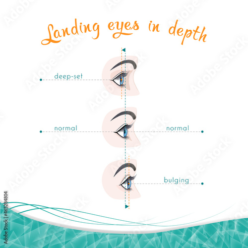 Types of eye landing in depth