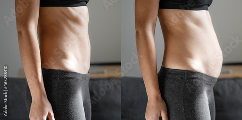 Before and after young woman side view of body. Swollen belly. Pregnancy. Diastasis recti after child birth. Fitness exercises and diet for weight loss.  photo