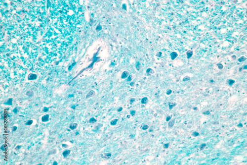 Cerebellum, Thalamus, Medulla oblongata, Spinal cord and Motor Neuron human under the microscope in Lab. © sinhyu