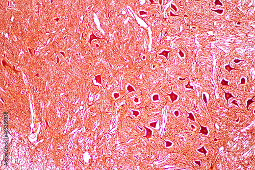 Cerebellum, Thalamus, Medulla oblongata, Spinal cord and Motor Neuron human under the microscope in Lab.
 photo