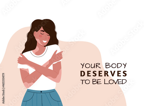 Vector illustration of smiling caucasian girl with vitiligo. World Vitiligo Day. Another kind of beauty. Love yourself, accept your body. Banner for international Vitiligo Day. White background.